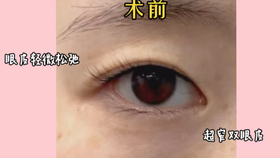 傻眉楞眼与生肖的奥秘联系