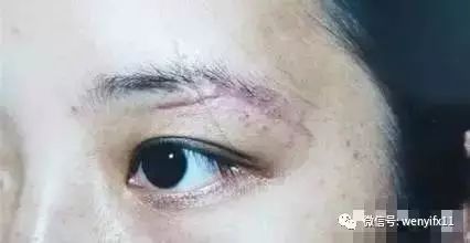 揭秘生肖面相之贼眉鼠眼，探寻神秘面相背后的秘密