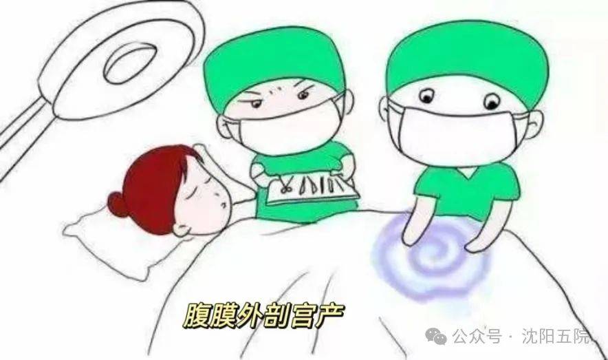 医生解读明星热衷的腹膜外剖宫产手术细节与优势
