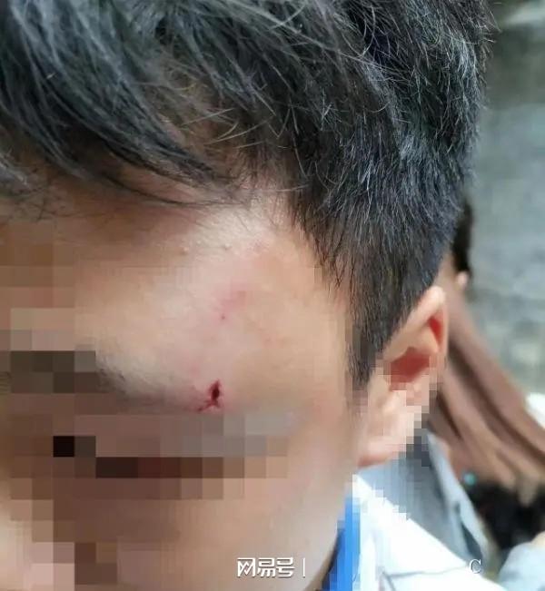 初中生课上遭同学用针文身事件揭秘，官方调查真相揭晓