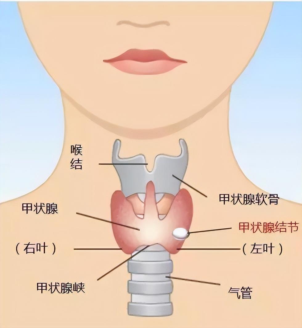 探究结节成因与真相，非情绪因素所致