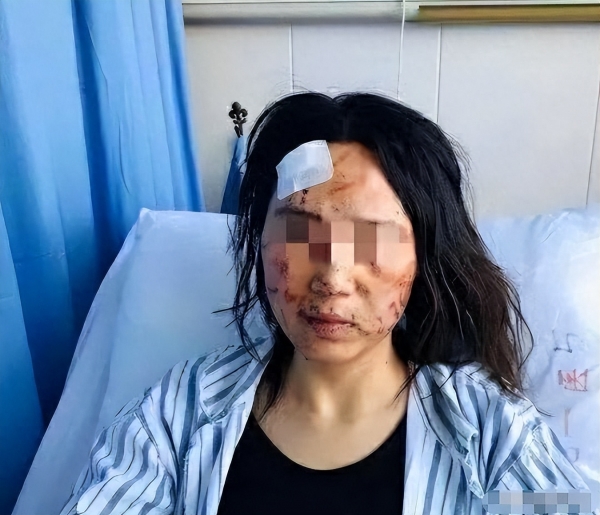 女子直播带货阴影下，两年遭遇十六次家暴的惊人真相