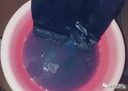 百元裤子掉色致女子双腿染紫，消费警示与权益维护探讨