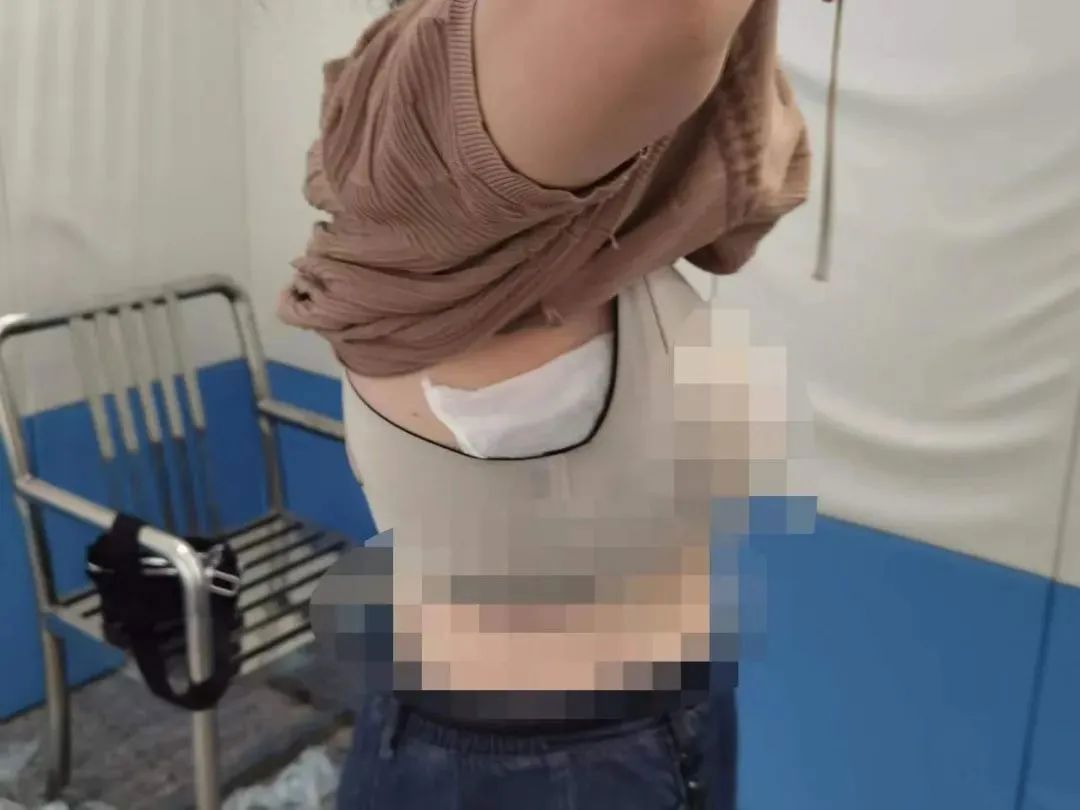 女子藏蛇于内衣闯关遭查，边境安全管理的重大警示
