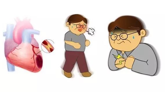心肌梗死高危时刻的警钟，十个关键时刻需警惕