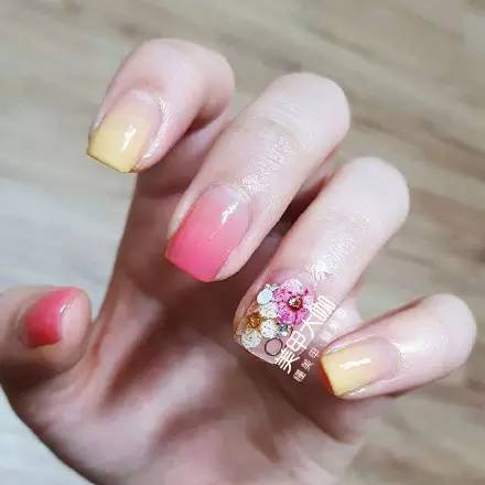 女子美甲过度引发甲周纤维瘤增长警告