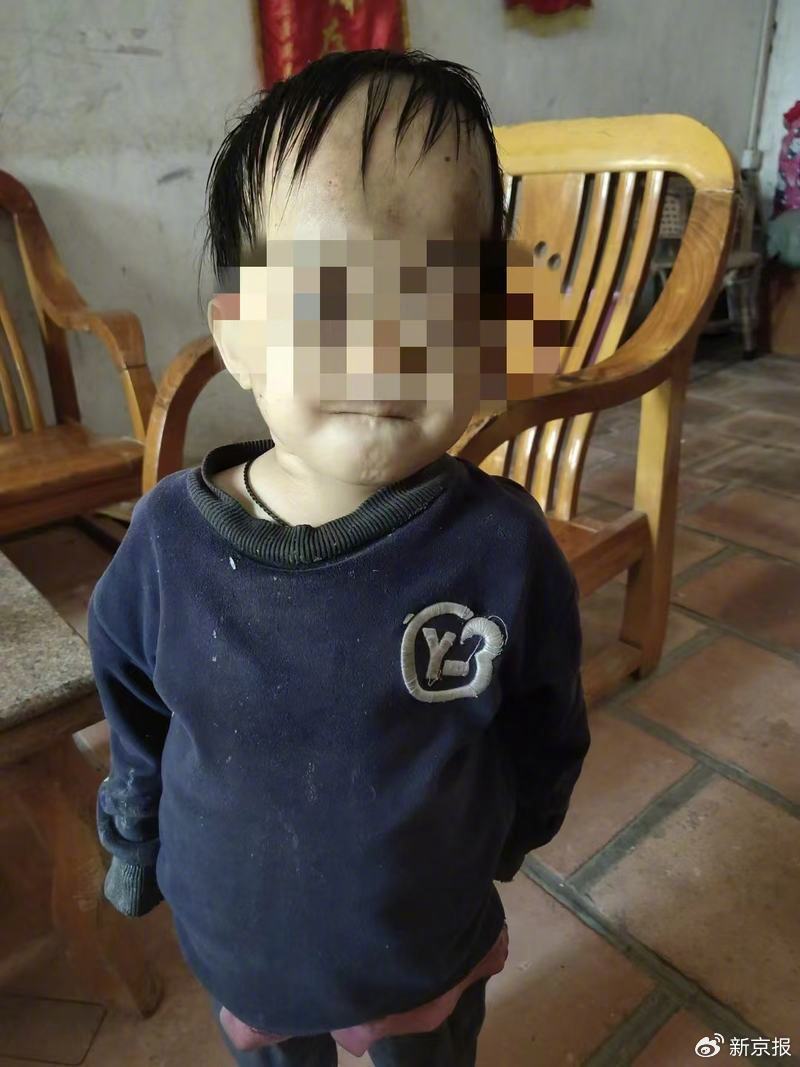 官方回应患病女童被遗弃事件，守护未成年，坚决拒绝任何形式的遗弃行为