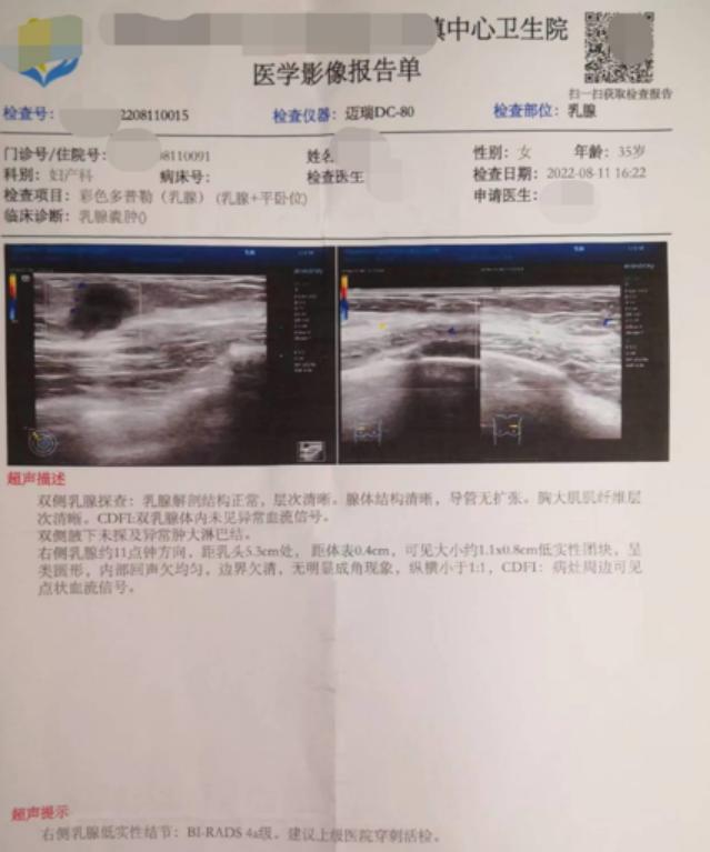 叶檀自述乳腺癌经历，勇敢面对，生命之花的再次绽放