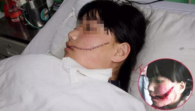 青春之痛，少女遭友人砍伤致残的警示与思考