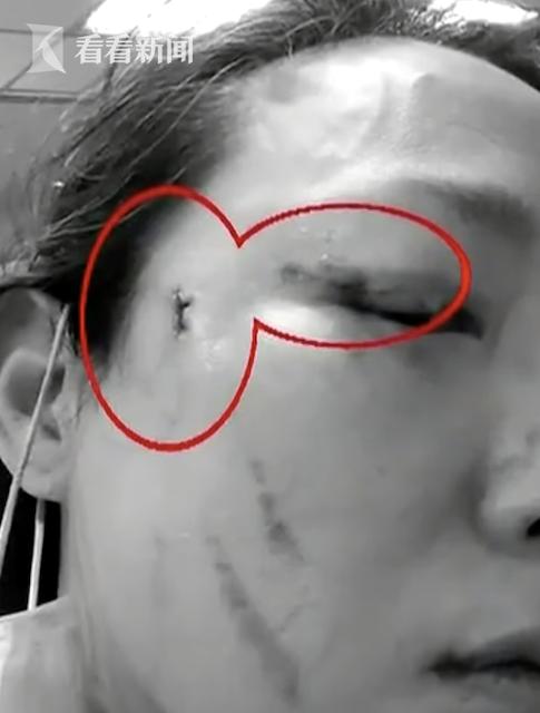 羁押死亡少年父亲事件，深度探究与反思，拷问下的自杀悲剧