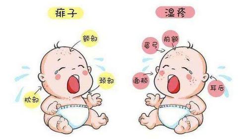 宝宝换季湿疹哭闹不止的科学护理指南